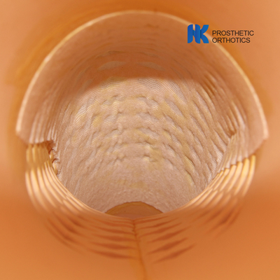 Prosthetic Pediatric Cosmetic Above Knee Using Cosmetic Cover (EVA) MESH